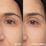 Retinol Eye Renewal - Retail