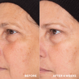 Retinol Routine Booster - Retail